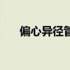 偏心异径管（请问什么是偏心异径管）