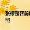 张檬整容前后照片对比 张檬以前现在的对比照