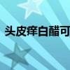 头皮痒白醋可以洗头吗 头皮痒怎么用醋洗头