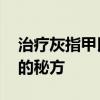治疗灰指甲民间偏方 农村土医生治疗灰指甲的秘方