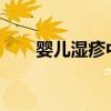 婴儿湿疹中药 宝宝得了湿疹怎么办？
