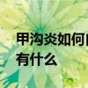 甲沟炎如何自己处理 甲沟炎疾病的治疗办法有什么