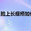脸上长痤疮如何治疗 医生治痤疮常用3种方式