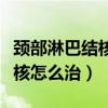 颈部淋巴结核怎么治疗效果最好（颈部淋巴结核怎么治）