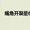 嘴角开裂是什么原因 嘴唇干裂是什么原因