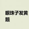 眼珠子发黄 眼球变黄，可能是身体出现了问题