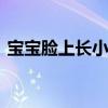 宝宝脸上长小红疙瘩 宝宝脸上红疙瘩怎么办