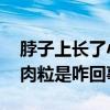脖子上长了小肉粒怎么回事 脖子上突然长小肉粒是咋回事