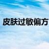 皮肤过敏偏方 7个小偏方教你治疗皮肤过敏！