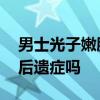 男士光子嫩肤价格 光子嫩肤有什么副作用和后遗症吗