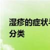 湿疹的症状与治疗 湿疹最典型的症状特点与分类