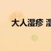 大人湿疹 湿疹，请收下这篇最全终结版