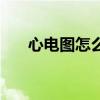 心电图怎么看算正常（心电图怎么看）
