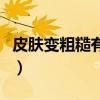 皮肤变粗糙有颗粒状图片(皮肤变粗糙怎么办) 皮肤变粗糙有颗粒状图片(皮肤变粗糙怎么办)