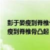 彭于晏瘦到脊椎骨凸起,广西北海市,离广州有多远（彭于晏瘦到脊椎骨凸起）