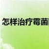 怎样治疗霉菌阴道炎（怎样治疗霉菌性阴炎）