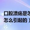 口腔溃疡是怎么引起的用什么药(口腔溃疡是怎么引起的) 口腔溃疡是怎么引起的用什么药(口腔溃疡是怎么引起的)