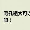 毛孔粗大可以用玻尿酸吗（毛孔粗大可以根治吗）