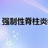 强制性脊柱炎症状表现（强制性脊柱炎症状）