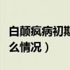 白颠疯病初期是什么样的（白颠疯病初期是什么情况）