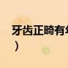 牙齿正畸有年龄限制吗?（正畸牙齿年龄限制）