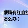 眼睛有红血丝怎么办快速消除(眼睛有红血丝怎么办) 眼睛有红血丝怎么办快速消除(眼睛有红血丝怎么办)