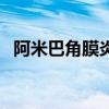 阿米巴角膜炎的典型特征（阿米巴角膜炎）