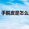 手脱皮是怎么回事小孩（手脱皮是怎么回事）