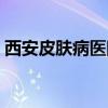 西安皮肤病医院十大排名（西安皮肤病医院）