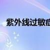 紫外线过敏症状及治疗（紫外线过敏症状）