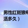 男性红斑狼疮一般能活多大寿命（红斑狼疮能活多久）