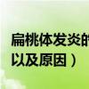 扁桃体发炎的症状和原因（扁桃体发炎的症状以及原因）