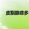 皮脂腺痣多大年龄手术最佳（皮脂腺痣）
