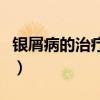 银屑病的治疗方法是什么（银屑病的治疗方法）