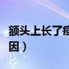 额头上长了痘痘什么原因(额头上长痘痘的原因) 额头上长了痘痘什么原因(额头上长痘痘的原因)