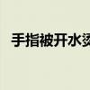 手指被开水烫伤怎么办（开水烫伤怎么办）
