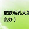 皮肤毛孔大怎么办有什么方法（皮肤毛孔大怎么办）