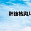 肺结核胸片报告单描述（肺结核胸片）