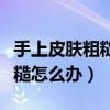 手上皮肤粗糙有什么办法可以解决（手皮肤粗糙怎么办）