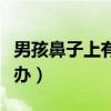 男孩鼻子上有黑头怎么办（鼻子上的黑头怎么办）