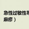 急性过敏性荨麻疹引起的原因（急性过敏性荨麻疹）