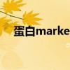 蛋白marker标准条带图(蛋白marker) 蛋白marker标准条带图(蛋白marker)