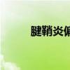 腱鞘炎偏方三七粉(腱鞘炎偏方) 腱鞘炎偏方三七粉(腱鞘炎偏方)