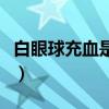 白眼球充血是怎么回事（眼底出血是怎么回事）