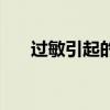 过敏引起的肠痉挛症状（肠痉挛症状）