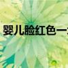 婴儿脸红色一块块的是不是过敏(婴儿脸红) 婴儿脸红色一块块的是不是过敏(婴儿脸红)