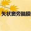 矢状窦旁脑膜瘤（关于矢状窦旁脑膜瘤介绍）