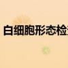 白细胞形态检查（关于白细胞形态检查介绍）