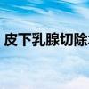 皮下乳腺切除术（关于皮下乳腺切除术介绍）