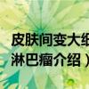 皮肤间变大细胞淋巴瘤（关于皮肤间变大细胞淋巴瘤介绍）